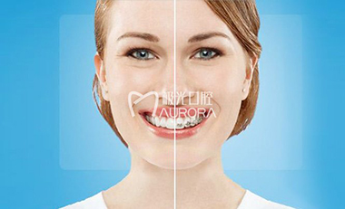 成人前牙突出能矫正吗